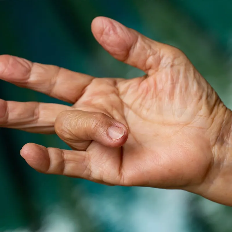 ACJA Shoulder Weakness