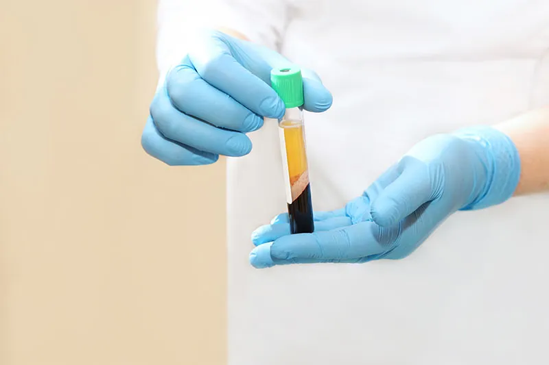 Platelet rich Plasma Injections